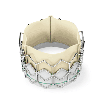 Image: The Sapien transcatheter aortic heart valve (Photo courtesy of Edwards Lifesciences).